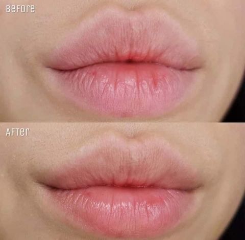 Tinh Chất Dưỡng Môi Unpa Bubi Bubi Lip 10gr