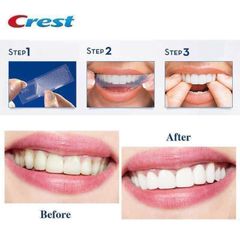 Miếng Dán Trắng Răng Cấp Tốc 1 Hour Crest 3D Whitestrips Dental Whitening Kit Levels 12