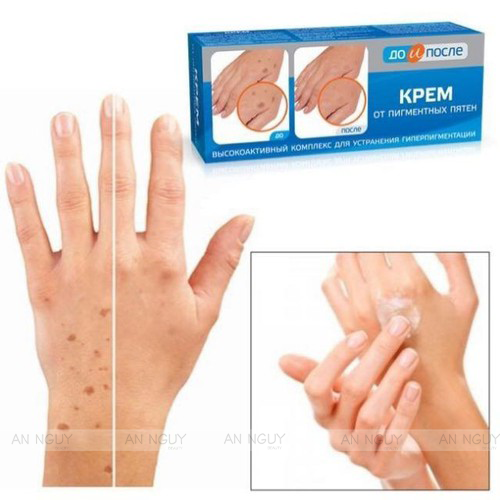 Kem Dưỡng Mờ Nám Tay Kpem Twins Tec Dưỡng Da Tay Mịn Màng 50ml