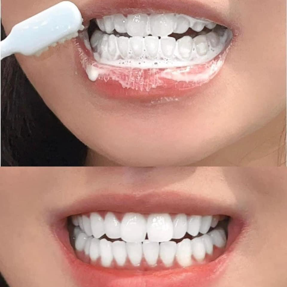 Kem Đánh Răng Marvis Toothpaste 85ml