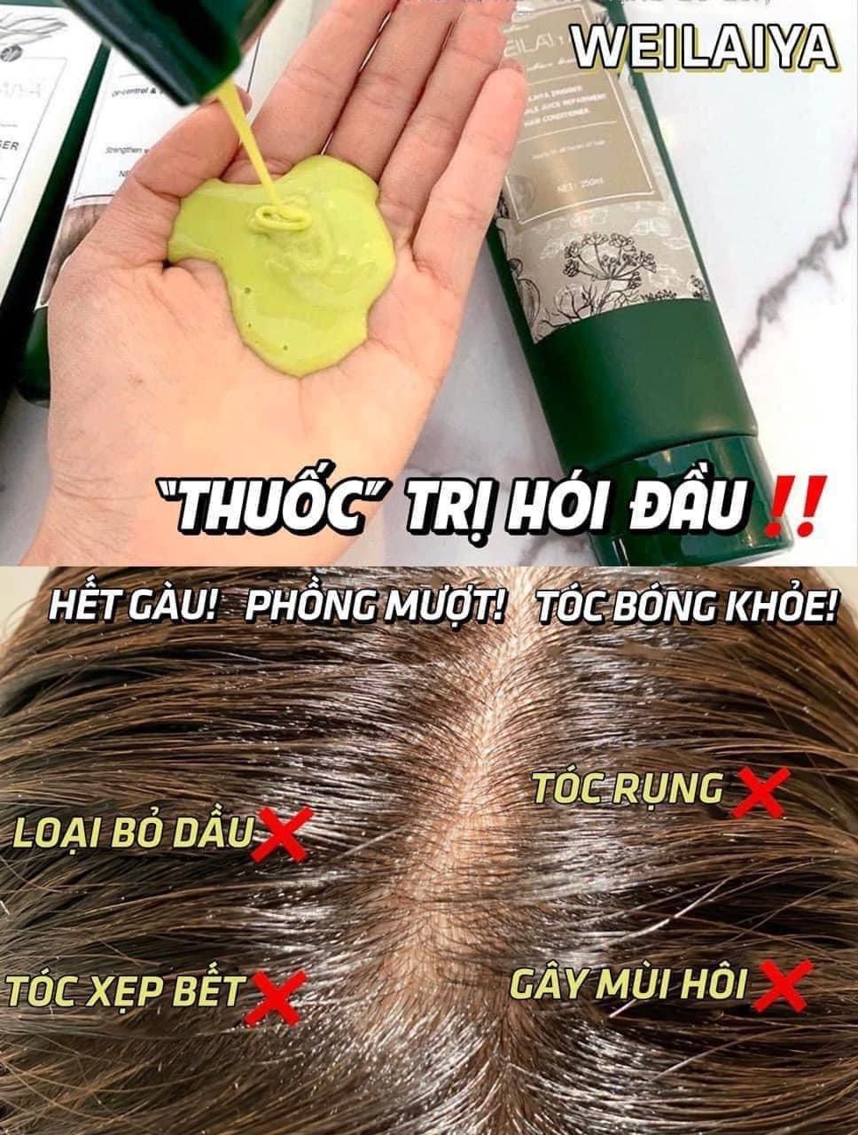 Bộ dầu gội xả chiết xuất gừng tươi Weilaya