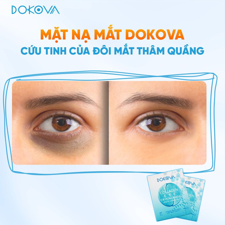 Mặt nạ mắt xóa quầng thâm xóa nhăn – Dokova Eye Mask