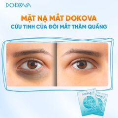 Mặt nạ mắt xóa quầng thâm xóa nhăn – Dokova Eye Mask