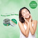  Mặt Nạ ACNES Bùn Non Dưỡng Sáng Da 100g - Sản Phẩm Chính Hãng Tại Zitore 