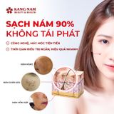  Trải nghiệm dịch vụ điều trị nám mảng, nám cháy nắng, sạm dạ 1 buổi 