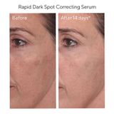  Serum Murad Rapid Dark Spot Correcting - Tinh chất giảm thâm nám nhanh (30ml/Chai) 