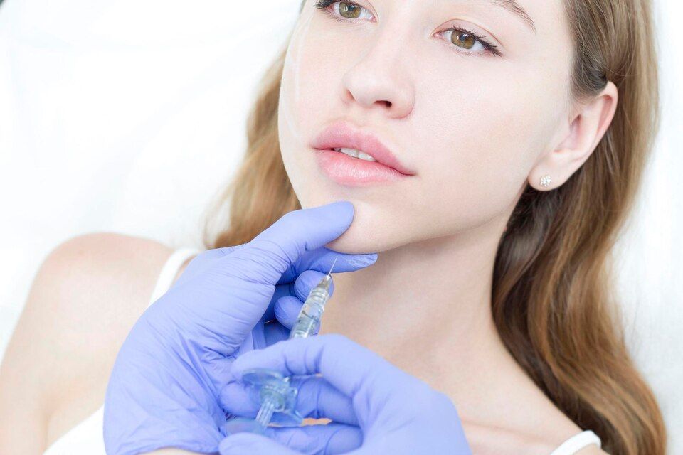Tiêm filler cằm