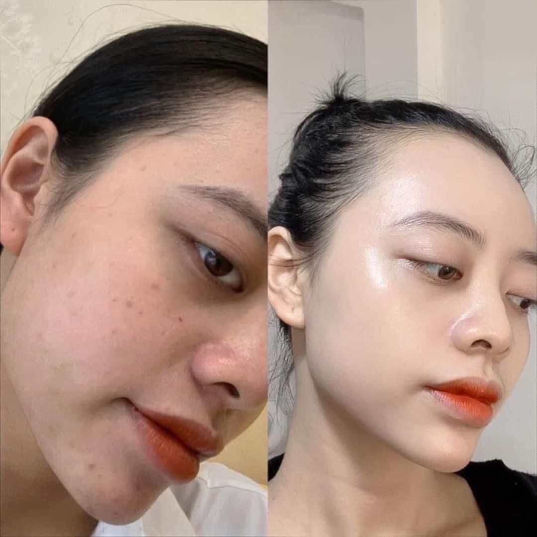 Tinh Chất Dưỡng Trắng Mờ Thâm PrettySkin Melas x Plus Whitening Care & Anti - Wrinkle 30ml