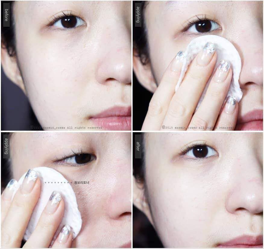 Nước hoa hồng dưỡng sáng da, trị nám Dongsung Rannce Skin 130ml