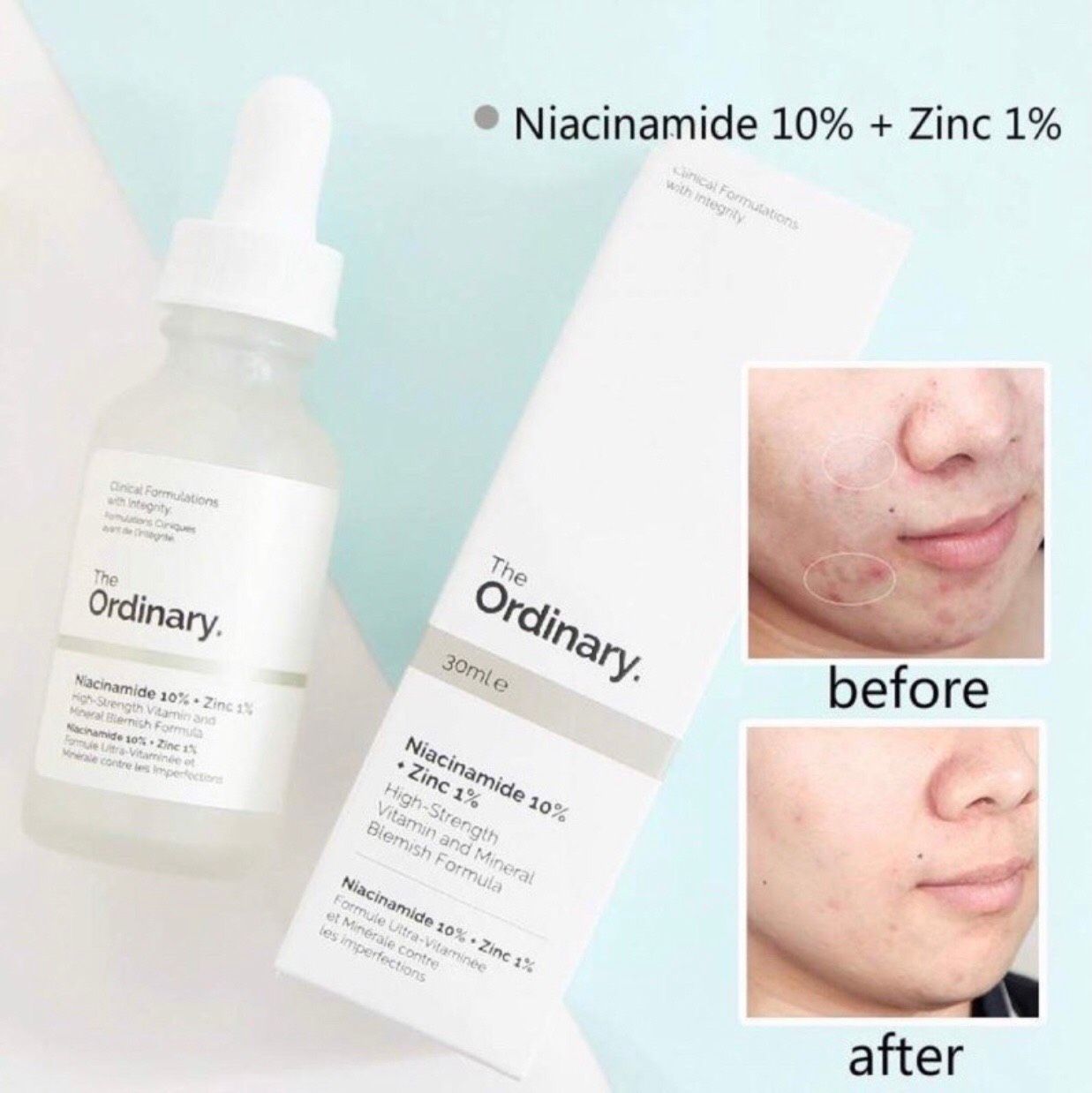 (NEW) Tinh Chất Sáng Da, Mờ Thâm Mụn The Ordinary Niacinamide 10% + Zinc 1%