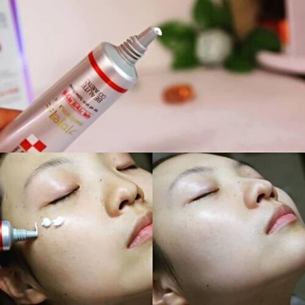 Kem dưỡng trị nám, tàn nhang Melasma-X 3D Whitening Clinic Cream 40ml