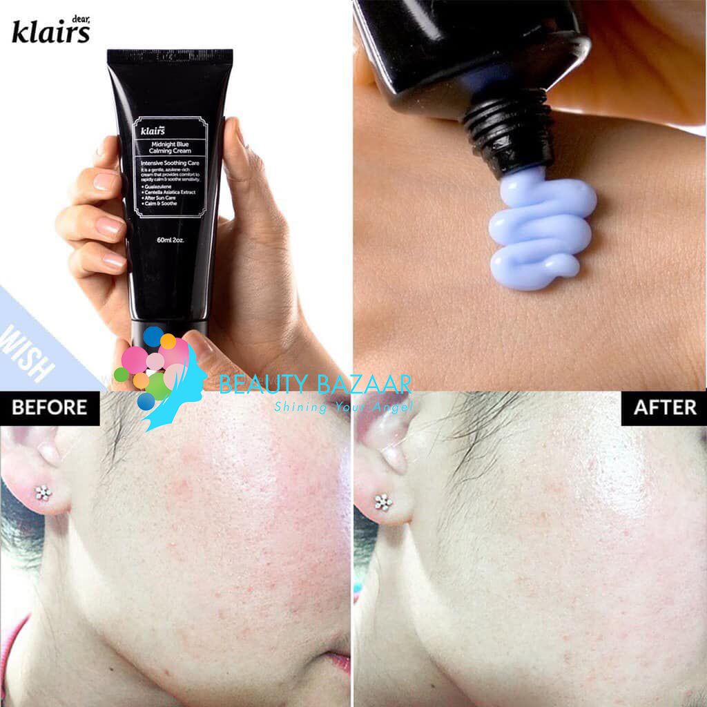 Kem dưỡng ẩm, phục hồi da Klairs Midnight Blue Calming Cream
