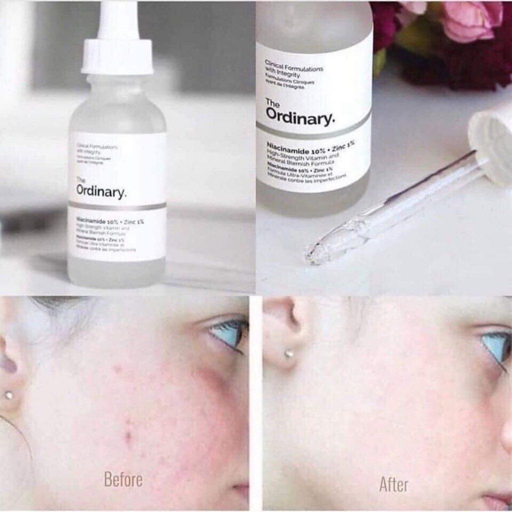 (NEW) Tinh Chất Sáng Da, Mờ Thâm Mụn The Ordinary Niacinamide 10% + Zinc 1%