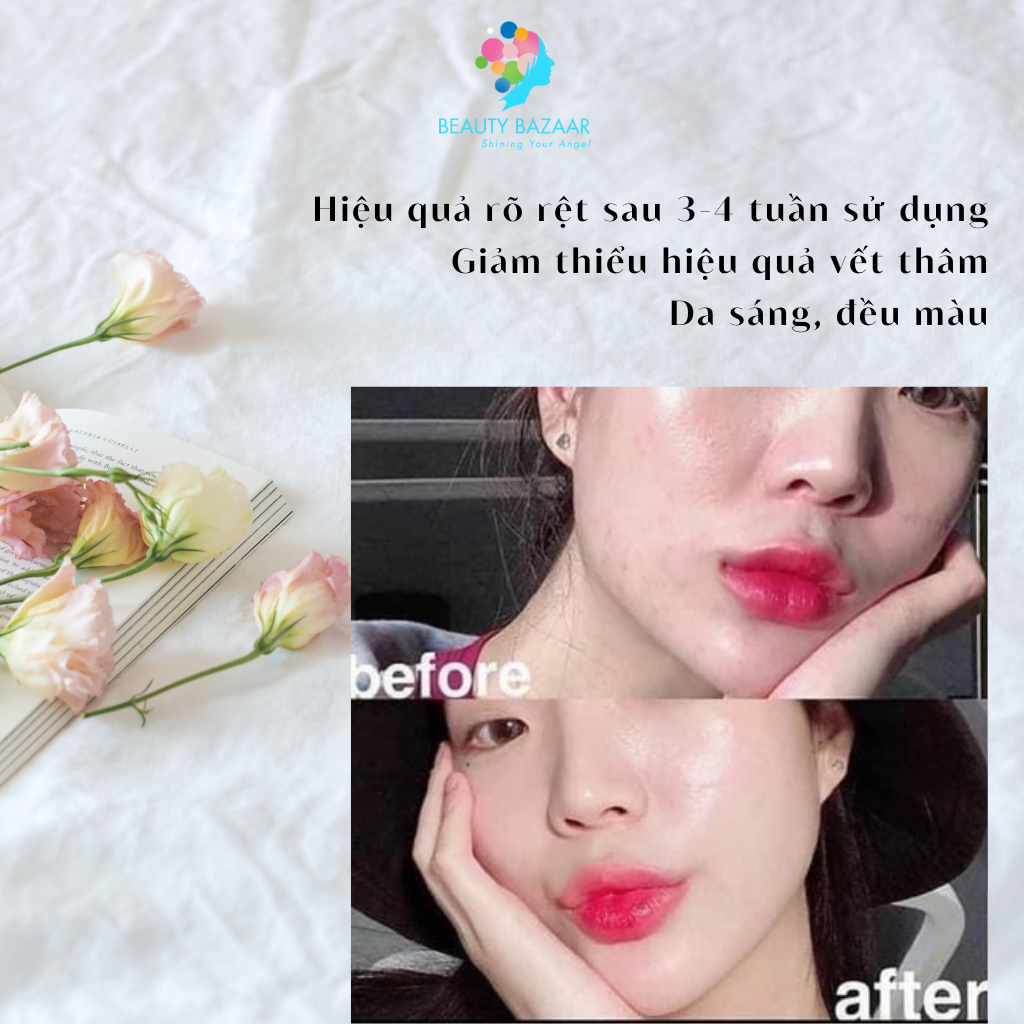 Tinh Chất Rau Má Trị Mụn Skin1004 Madagascar Centella Asiatica 100 Ampoule