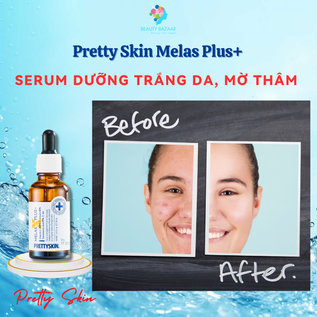 Tinh Chất Dưỡng Trắng Mờ Thâm PrettySkin Melas x Plus Whitening Care & Anti - Wrinkle 30ml