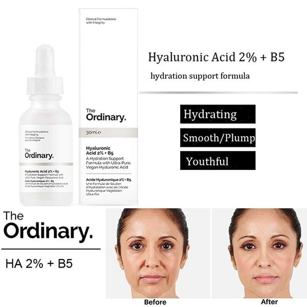 (Bản Hàn/Canada) Tinh Chất Cấp Nước The Ordinary Hyaluronic Acid 2% + B5