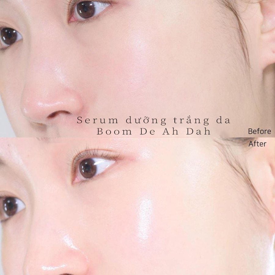 Tinh Chất Dưỡng Trắng Boom De Ah Dah Niacinamide 10% + Arbutin 2% 50ml