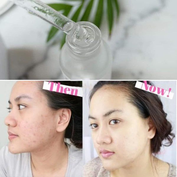 Tinh Chất Dưỡng Trắng Da Mờ Thâm The Ordinary Alpha Arbutin 2% + HA 30ml