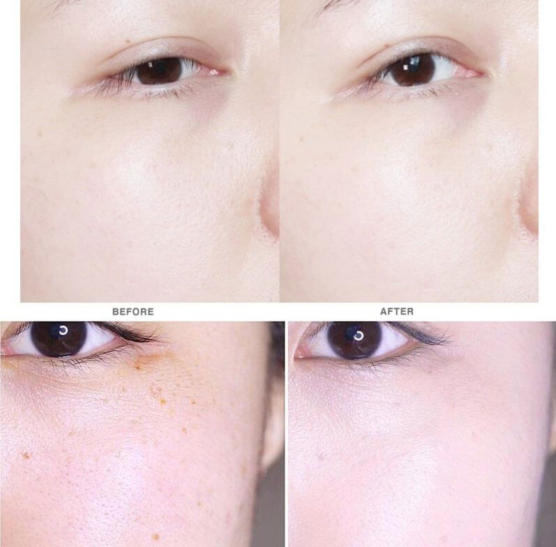 Nước hoa hồng dưỡng sáng da, trị nám Dongsung Rannce Skin 130ml
