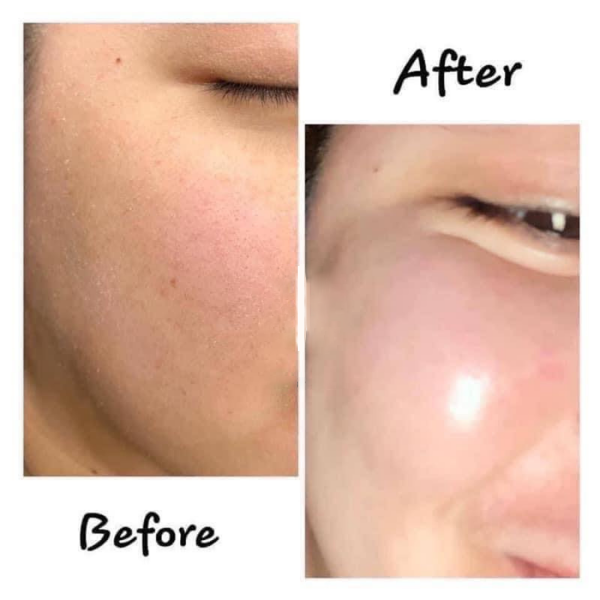 Tinh Chất Cấp ẩm, Phục Hồi Da Mediphar+ Hydrating B5 30ml