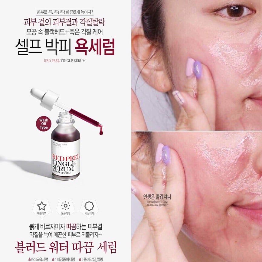 Tinh Chất Tẩy Da Chết Hóa Học So’Natural Red Peel Tingle Serum 35ML