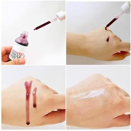 Tinh Chất Tẩy Da Chết Hóa Học So’Natural Red Peel Tingle Serum 35ML