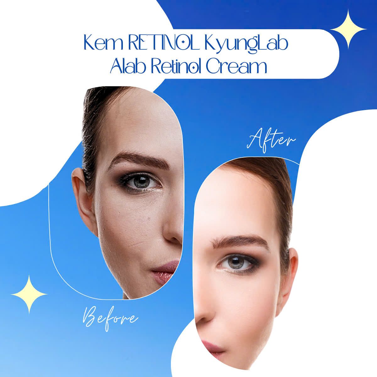 Kem retinol KyungLab Alab Retinol Cream dưỡng ẩm phục hồi da chống lão hoá 30ml Hàn Quốc