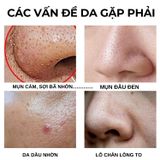  Mặt nạ đất sét giảm mụn kiềm dầu da tươi xinh Doctor care Oroxylum Face Mask WHITE CLAY Frankincense 50g 