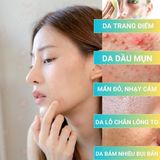  Bộ Làm Sạch Da Ngừa Mụn Tẩy Trang & Sữa Rửa Mặt Oroxylum dành cho nam nữ da dầu mụn da nhạy cảm (Sữa rửa mặt 130g + tẩy trang 200ml) 