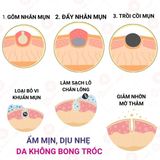  Bộ Tri Mụn ẩn , Mụn đầu đen, Mụn thâm Doctor Care dịu nhẹ dành cho nam nữ da dầu mụn ( Kem 30g + Toner 200ml +sữa rửa mặt 130g) 