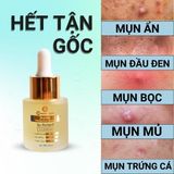  Serum Trị  Mụn Ẩn, Mụn Đầu Đen , Mụn Thâm  Doctor Care 20ml 