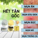  Bộ Tri Mụn ẩn ,Mụn đầu đen,Mụn thâm Doctor Care  (serum+ kem+ mặt nạ) 