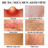 Toner cân bằng và làm dịu da, giảm sưng viêm giảm mụn Oroxylum Active Nutrient Complex Skin  Doctor care 