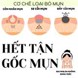  Serum Doctor care Giải pháp hoàn hảo cho làn da sạch mụn tận gốc 