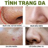 Mặt nạ đất sét kiềm dầu giảm mụn đầu đen, mụn cám Oroxylum Face Mask Doctor care