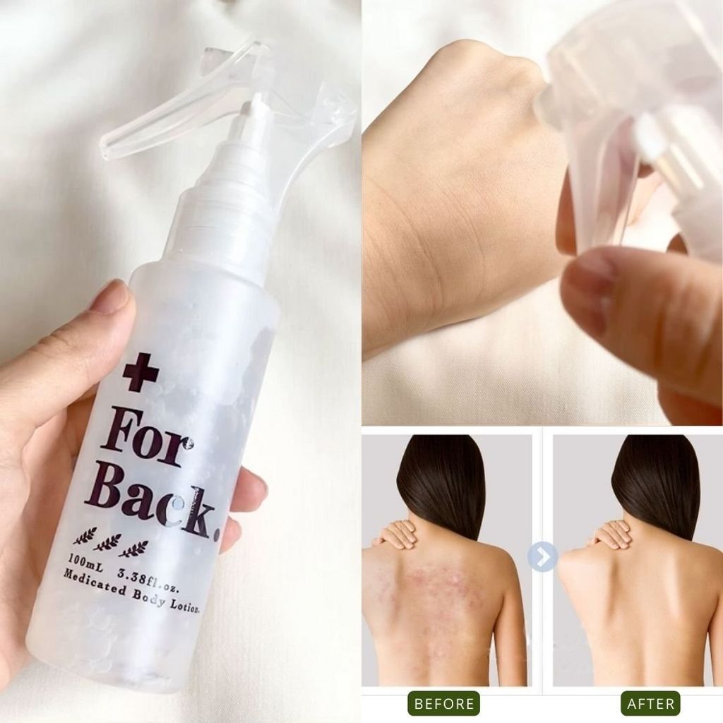 Xịt trị mụn lưng For Back Nhật 100ml