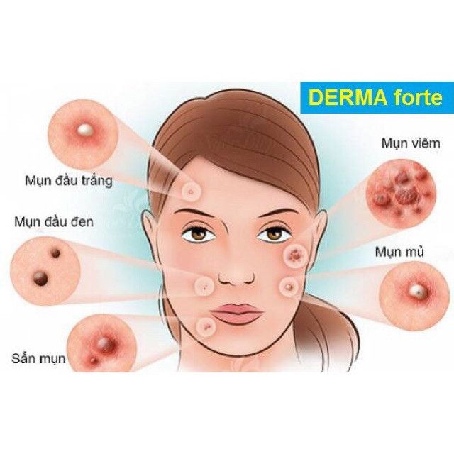 Derma Forte 15g