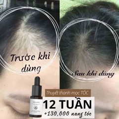 Huyết Thanh Kích Thích Mọc Tóc Weilaiya Hair Growth Serum (5ml x 8 chai)