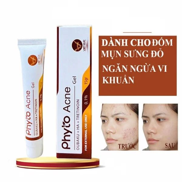 Kem Mụn Phyto Acne Gel 0.1% 15g