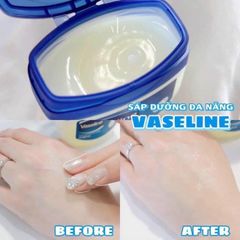 Sáp Dưỡng Ẩm Vaseline 100% Pure Petroleum Jelly Original #106g