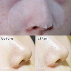 Serum đẩy mụn Ciracle (1 Cặp-Vỏ trắng)