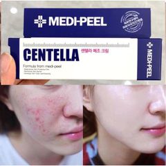 Kem Trị Mụn Phục Hồi Da Medi Peel Centella Mezzo Cream 30ml