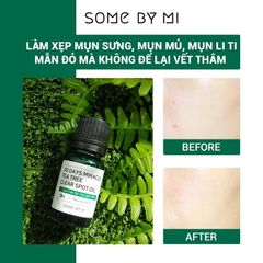 Tinh Dầu Tràm Trà Some By Mi 30 Days Miracle Tea Tree Clear Spot Oil 10ml