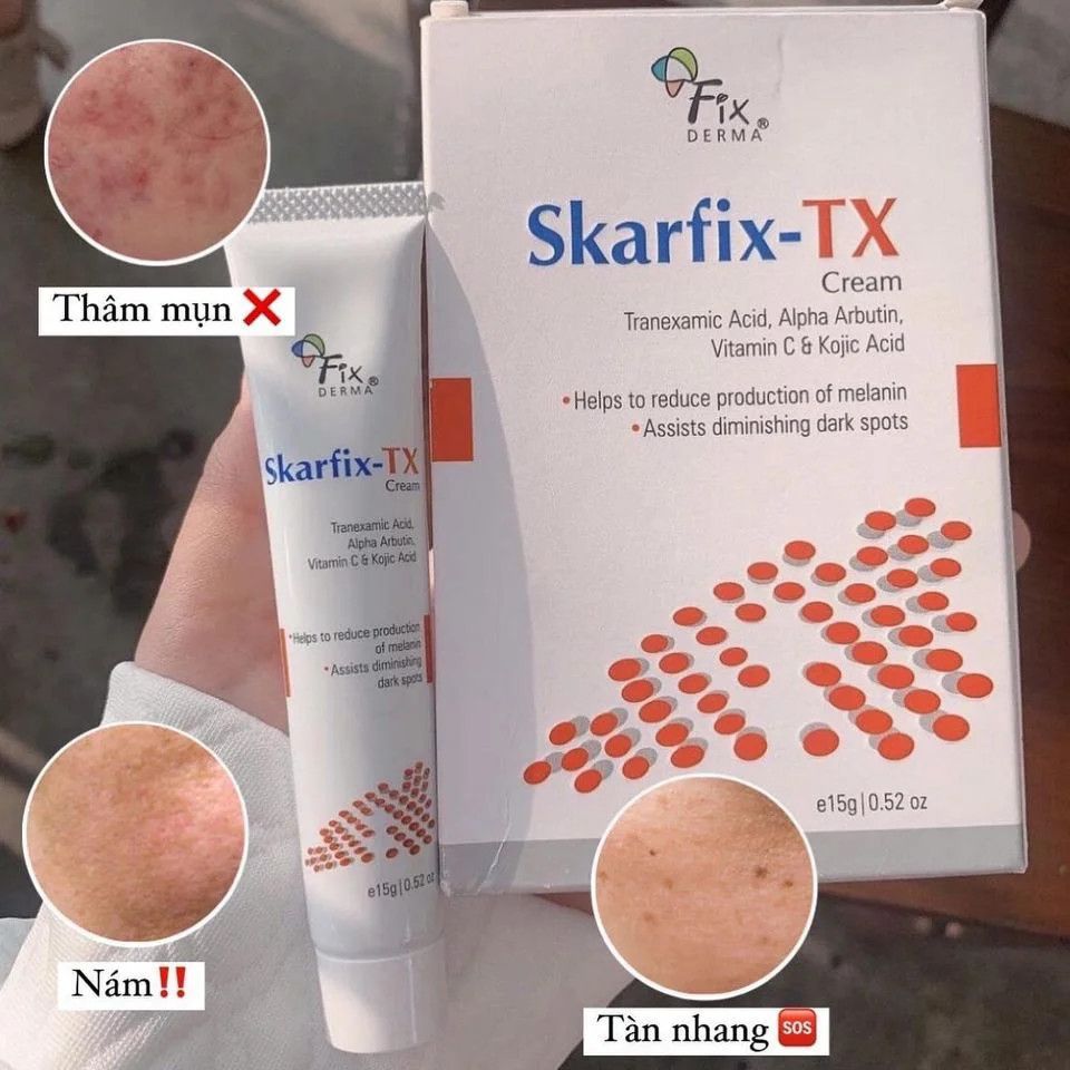 Kem Dưỡng Da Mờ Thâm Nám, Tàn Nhang Fixderma Skarfix-TX Cream 15gr