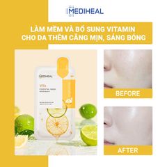 Mặt Nạ Mediheal Essential Mask Vita Active