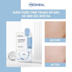 Mặt Nạ Mediheal Essential Mask #Watermide