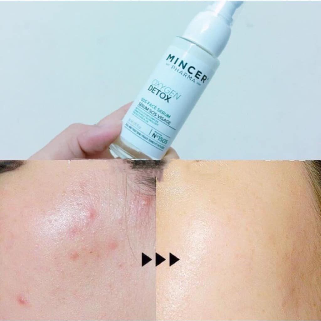 Tinh Chất Mincer Pharma Detox Phục Hồi, Ngừa Lão Hoá 30ml Oxygen Detox SOS Face