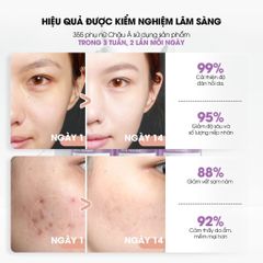 Serum Neogen Dermalogy Real Bakuchiol Ngừa Lão Hoá, Mờ Nếp Nhăn 30ml