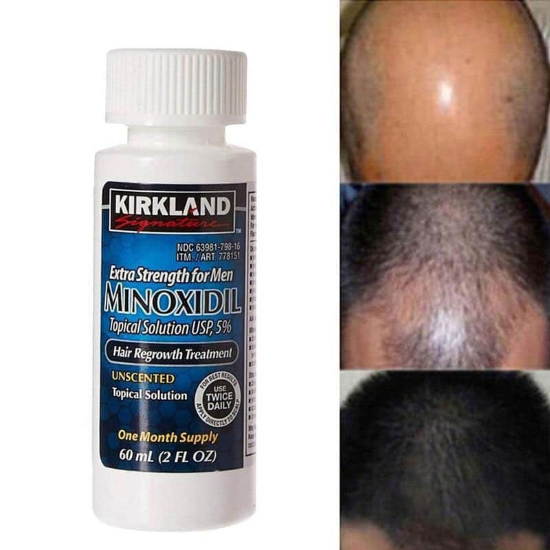 Dung Dịch Hỗ Trợ Mọc Tóc KIRKLAND Minoxidil 5%