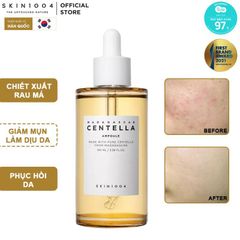 Tinh chất rau má trị mụn Skin1004 Madagascar Centella Ampoule 55ml